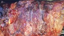 North Carolina-Style Pulled Pork